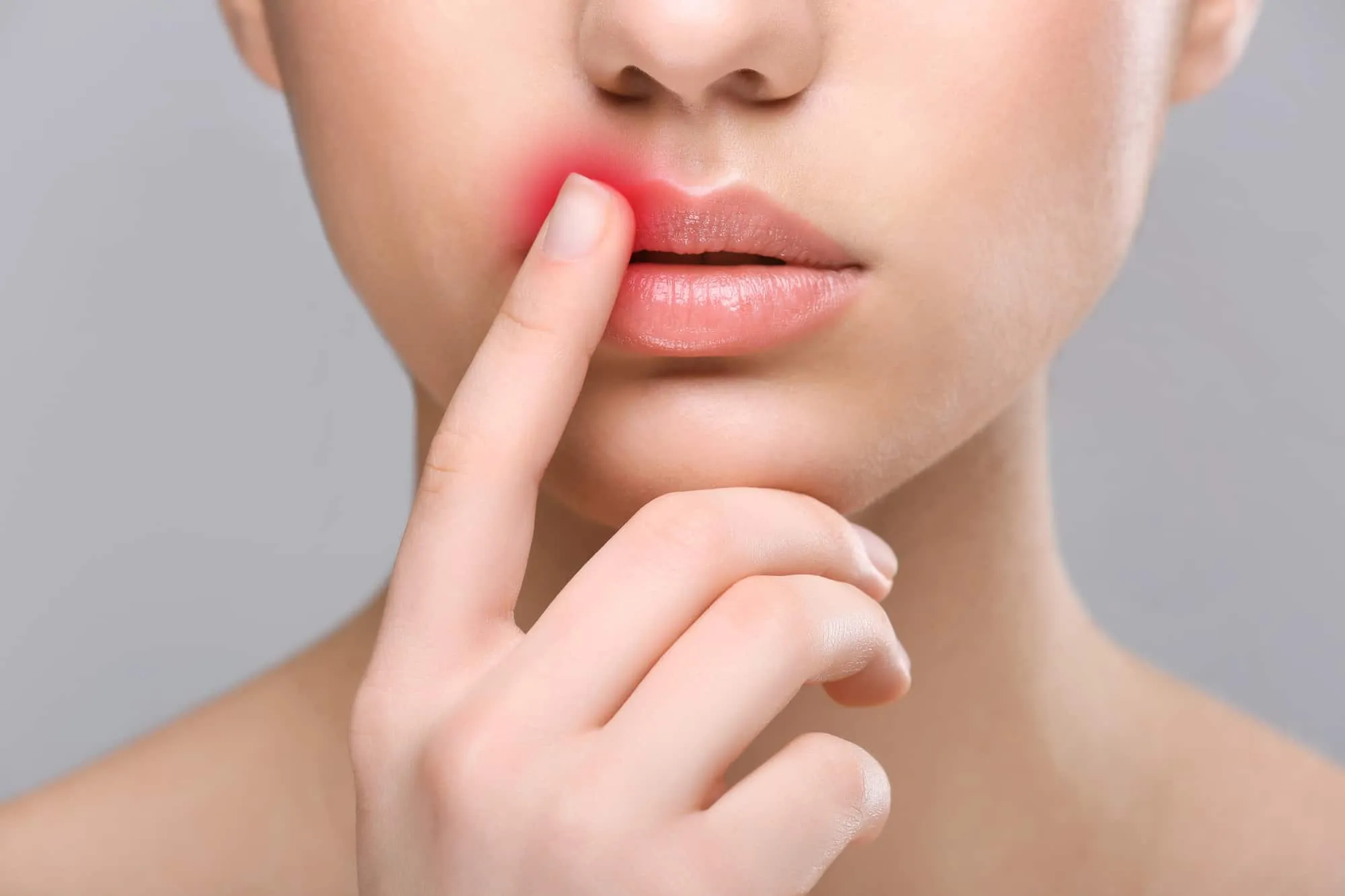 Découverte des traitements naturels contre les boutons de fièvre